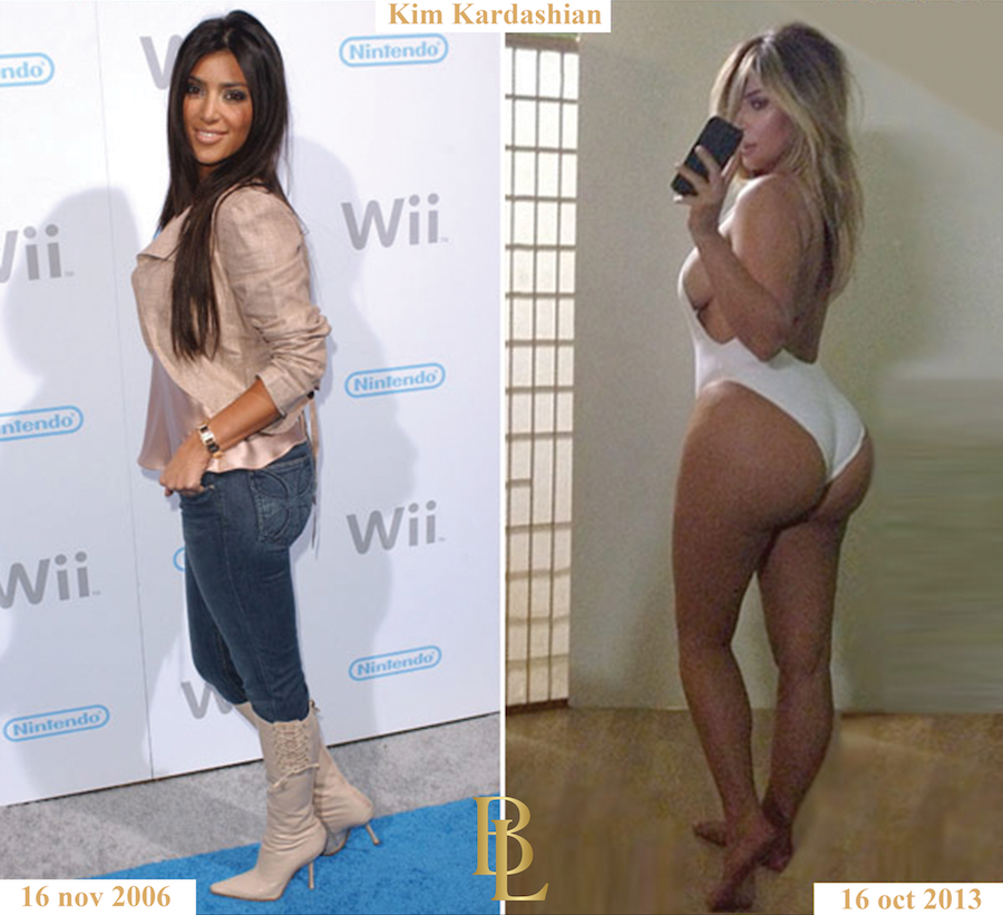 kim kardashian avant apres fesses